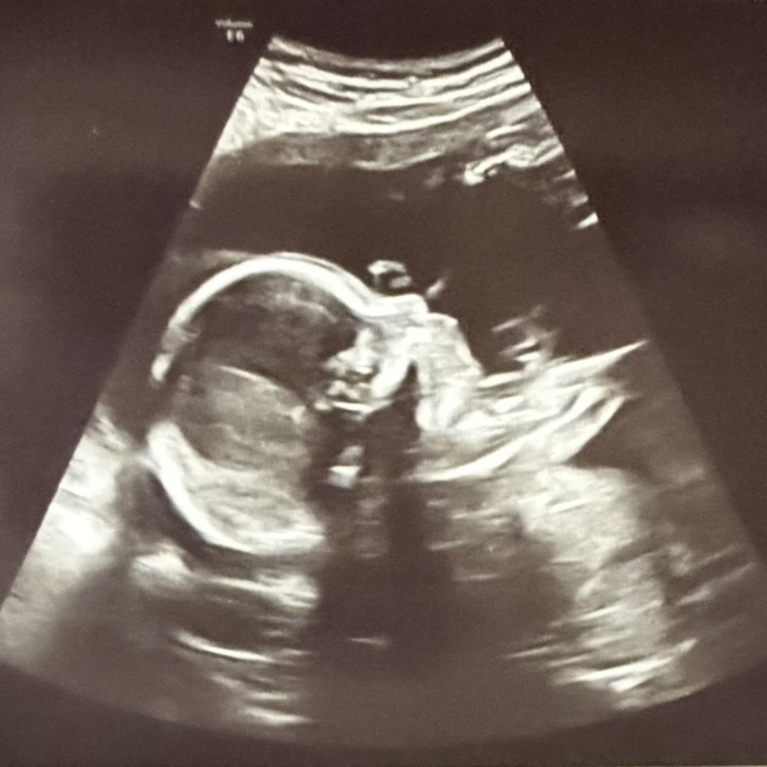 Photo shared by Maddison for their Babylist baby registry.