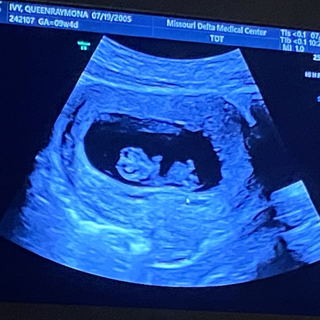 Photo shared by QueenRaymona for their Babylist baby registry.