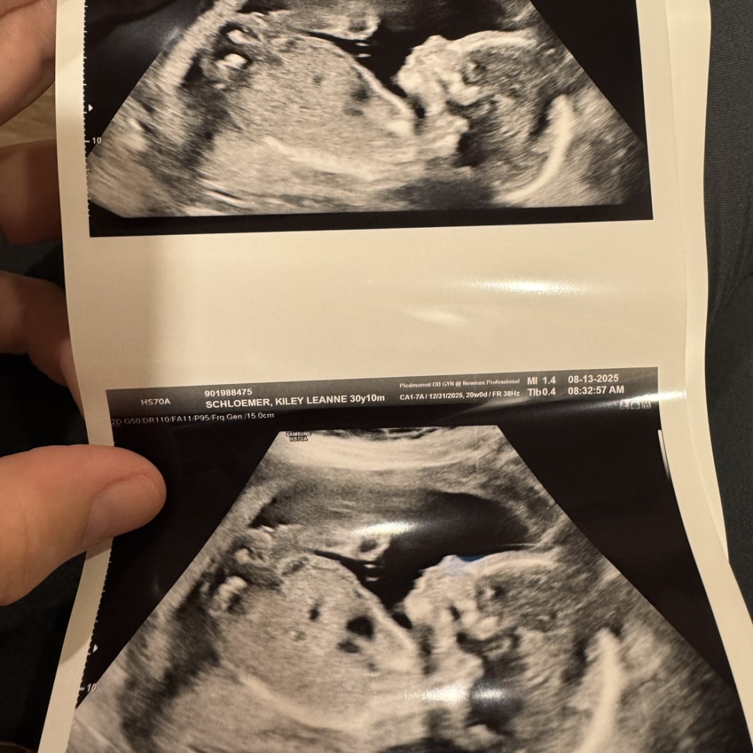 Photo shared by Kiley for their Babylist baby registry.