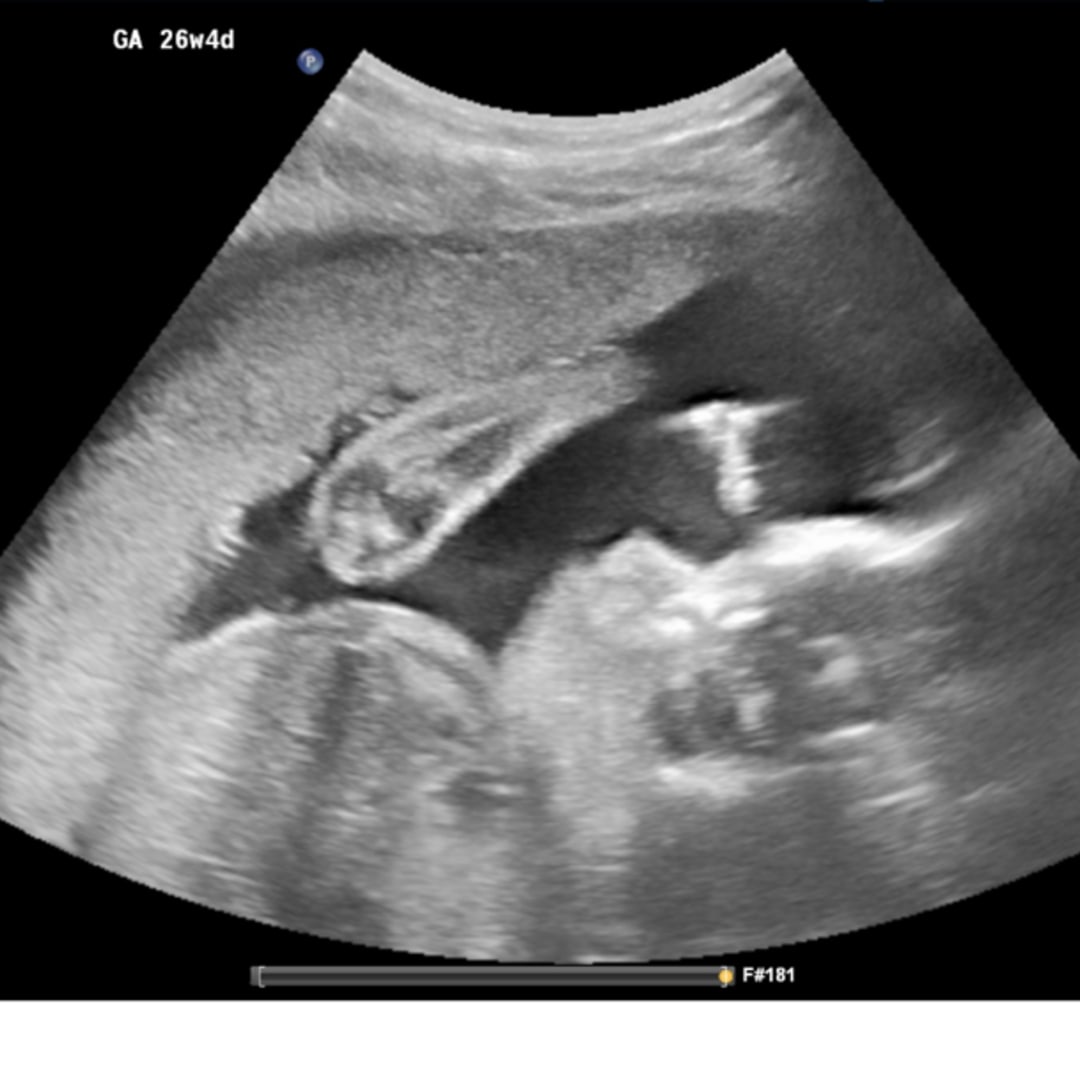 Photo shared by Alicia for their Babylist baby registry.