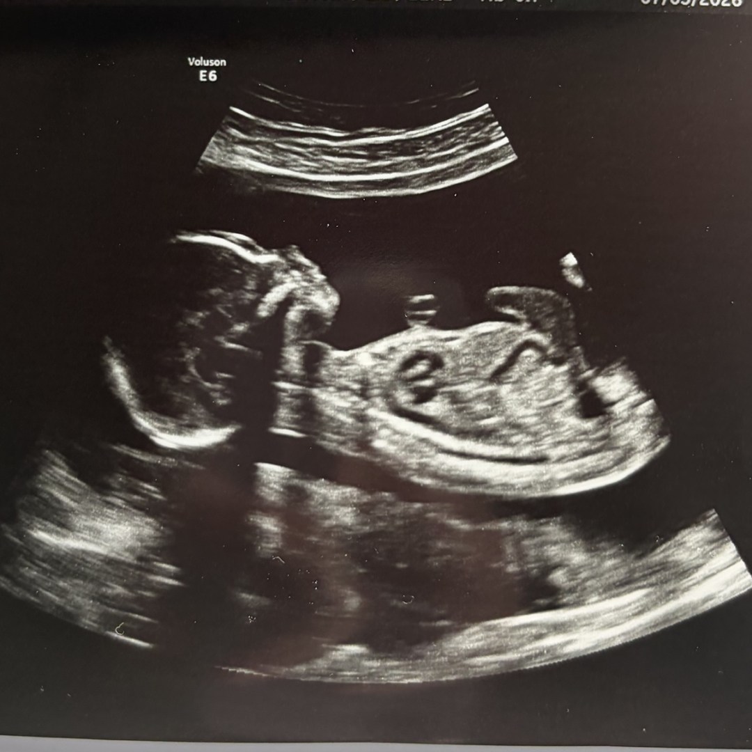 Photo shared by Isabelle for their Babylist baby registry.