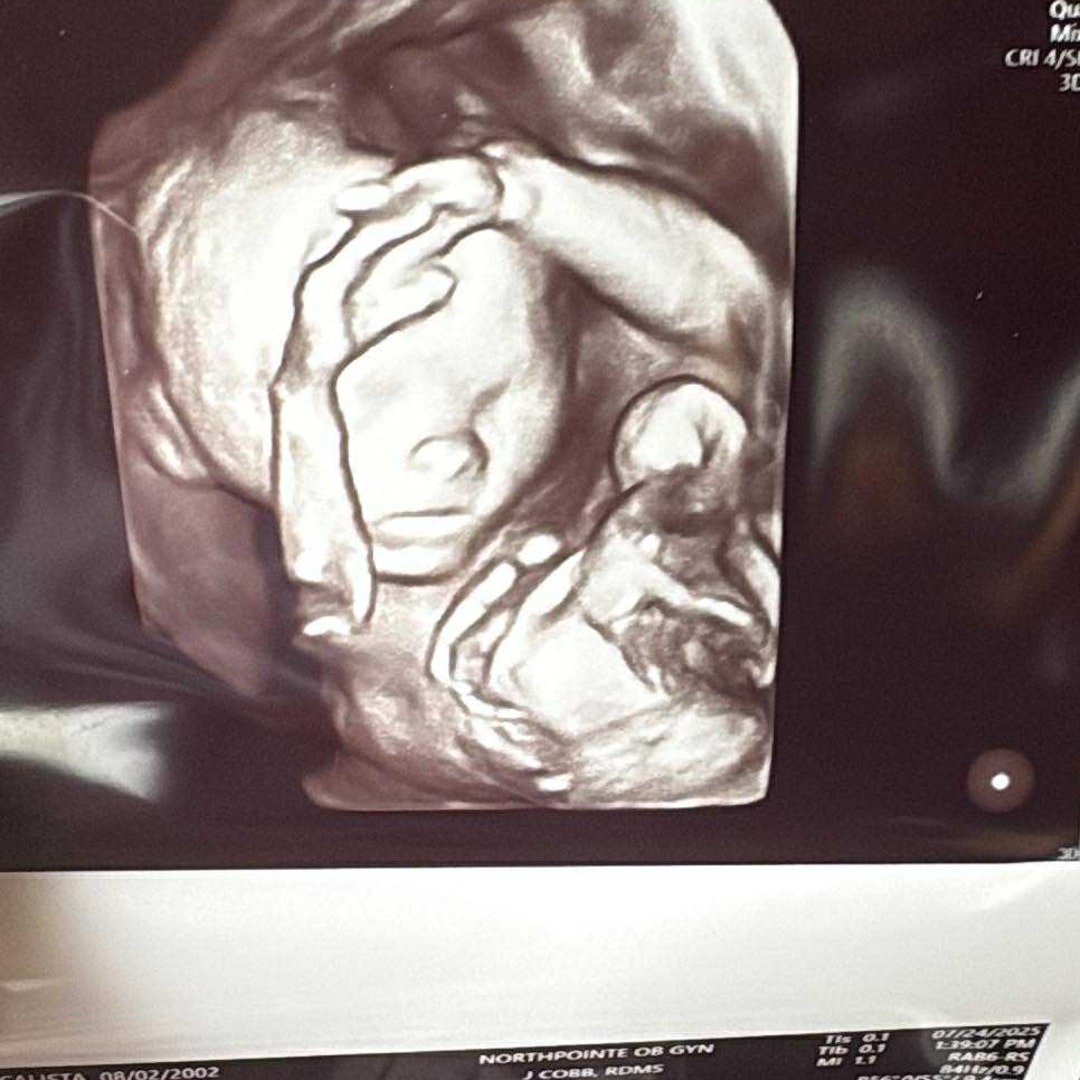 Photo shared by Calista for their Babylist baby registry.