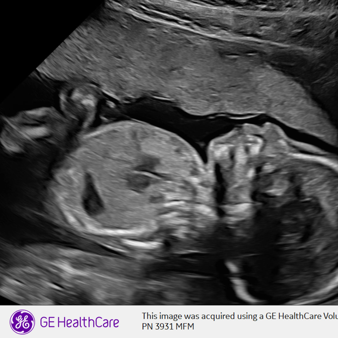 Photo shared by Becky for their Babylist baby registry.