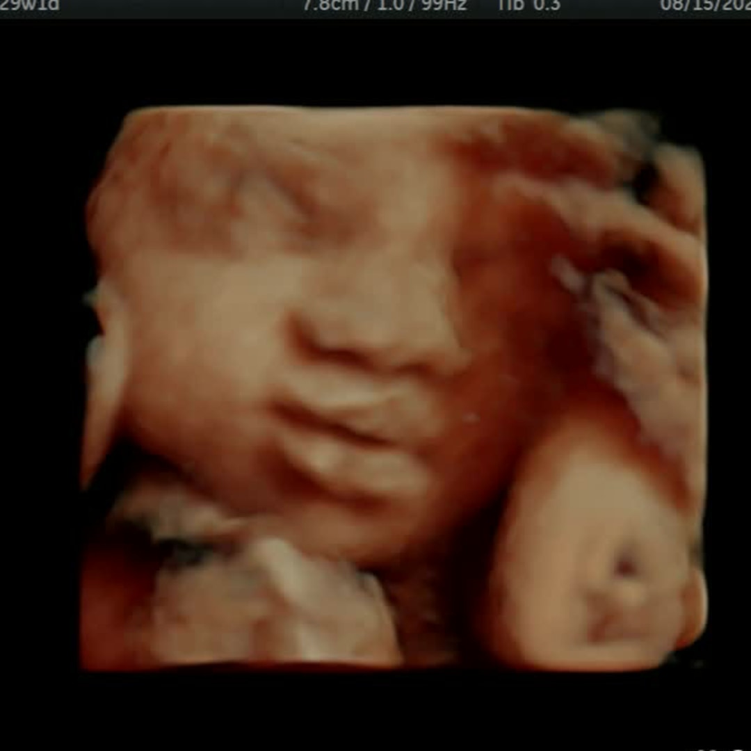 Photo shared by Nevaeh for their Babylist baby registry.