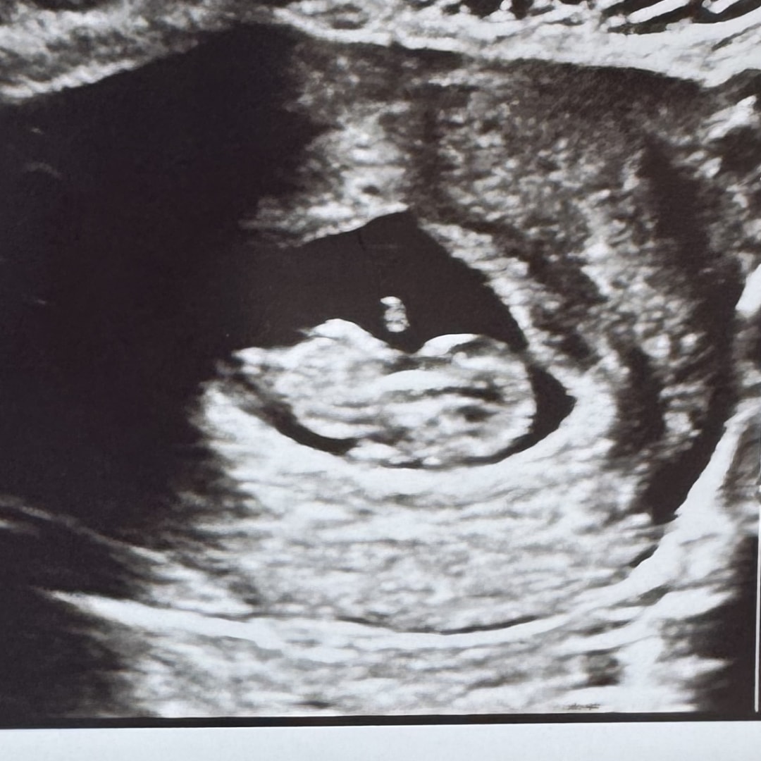 Photo shared by Shaniqua for their Babylist baby registry.