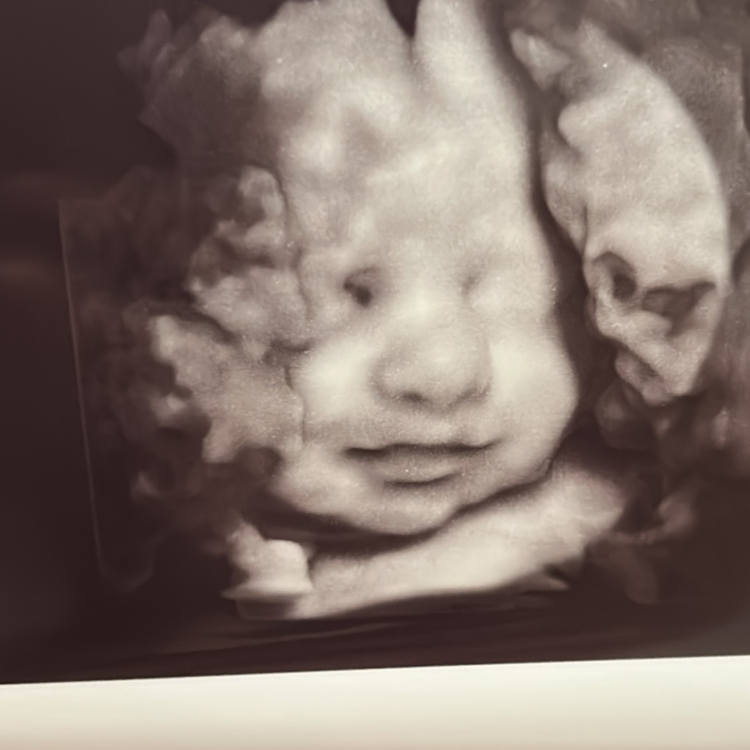 Photo shared by Vashista for their Babylist baby registry.