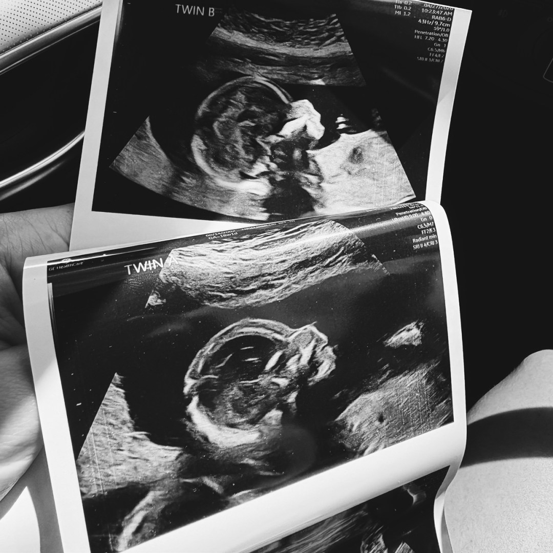 Photo shared by Ally for their Babylist baby registry.