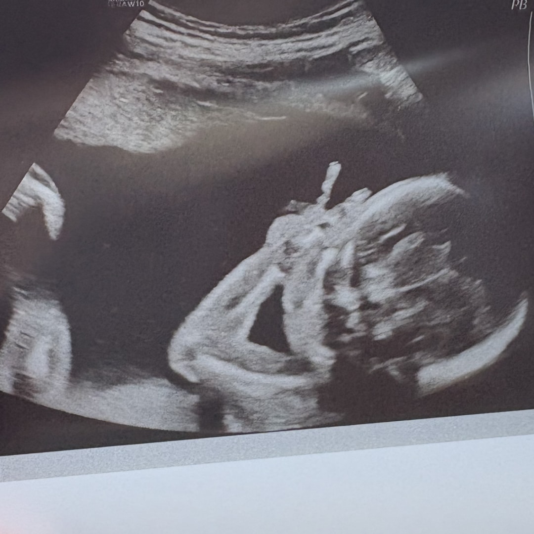 Photo shared by Hailey for their Babylist baby registry.