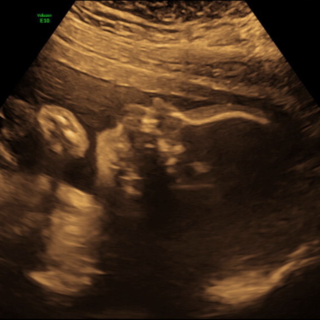 Photo shared by Yvette for their Babylist baby registry.