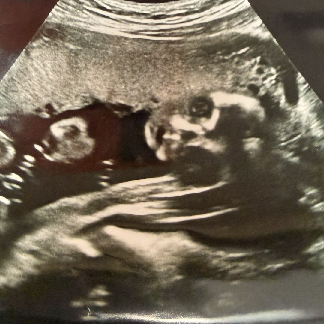 Photo shared by Lora for their Babylist baby registry.