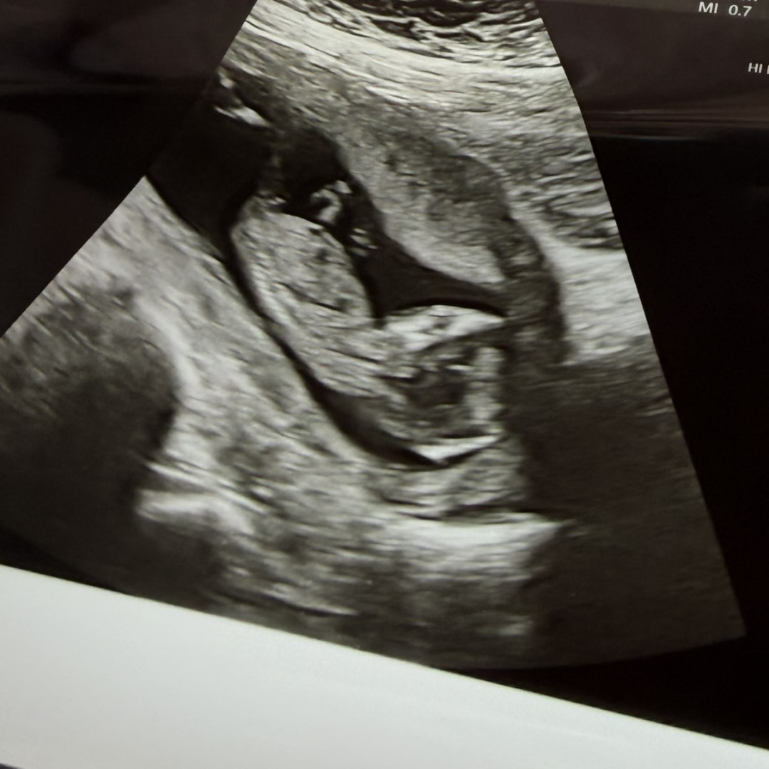 Photo shared by Lauren for their Babylist baby registry.