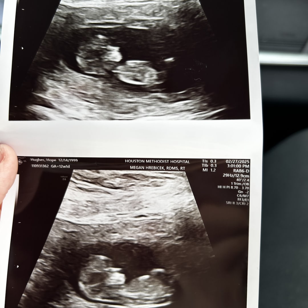 Photo shared by Hope for their Babylist baby registry.
