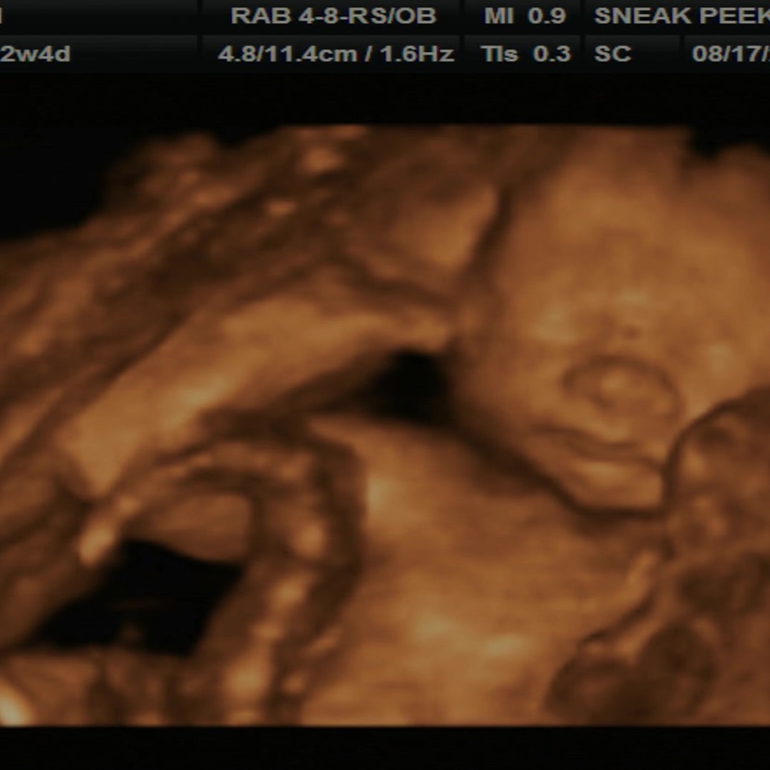 Photo shared by Autumn for their Babylist baby registry.