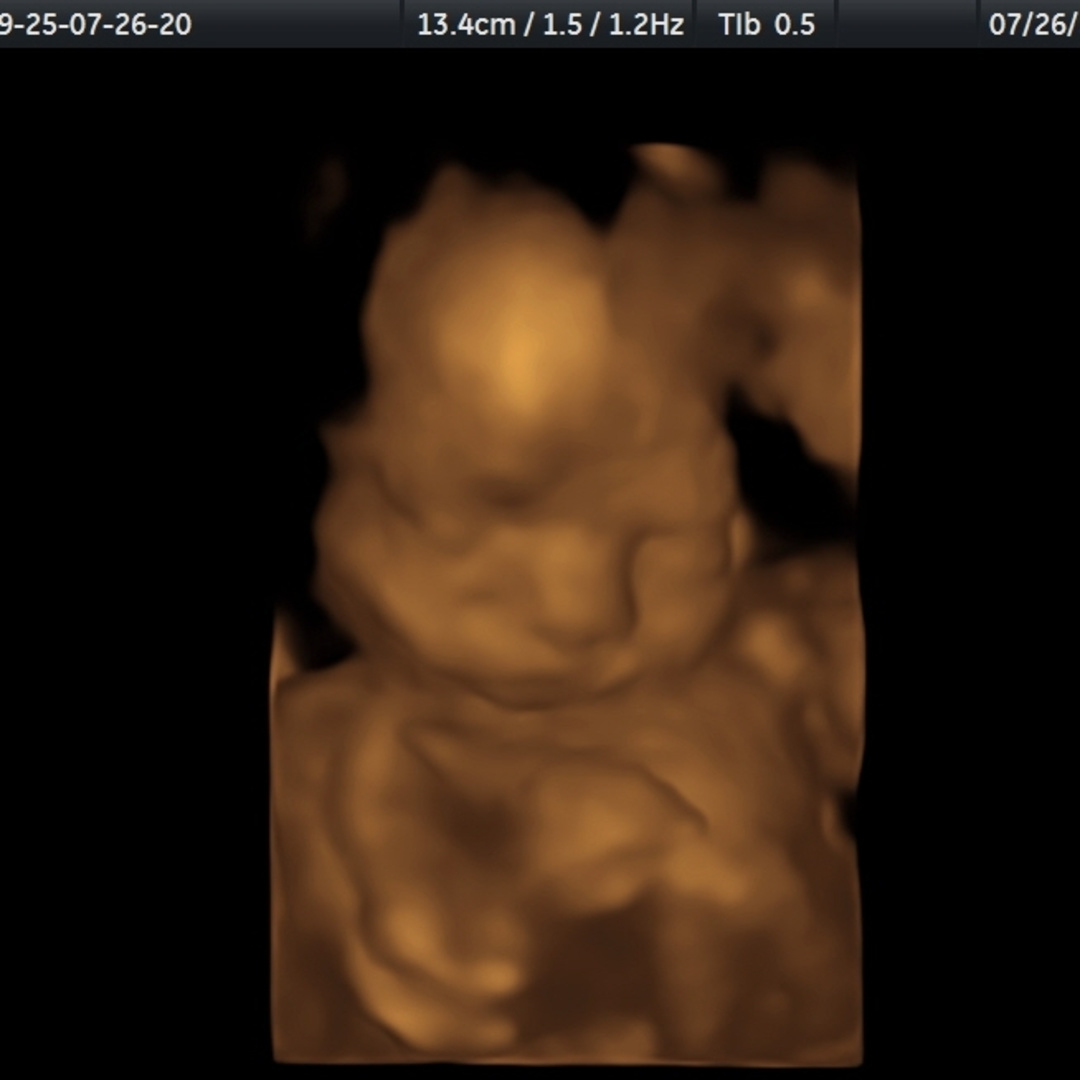 Photo shared by Audrey for their Babylist baby registry.