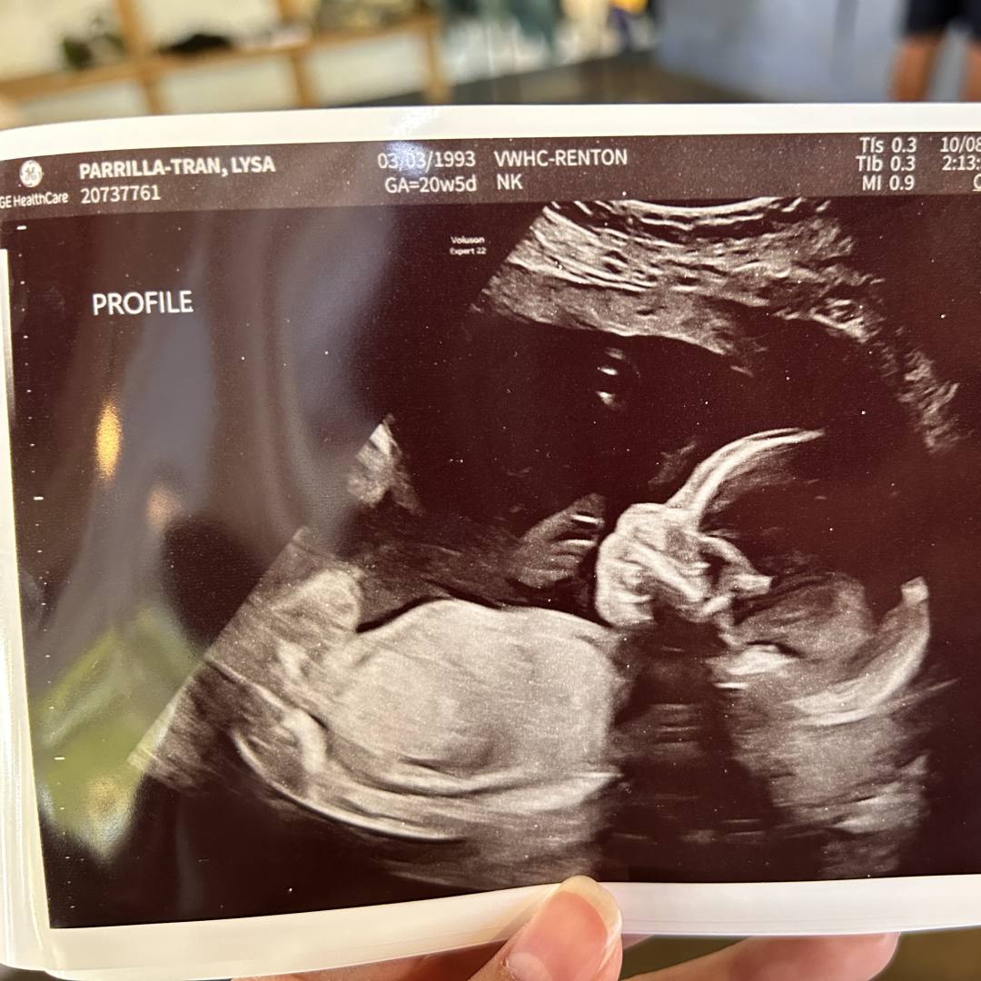 Photo shared by Lysa for their Babylist baby registry.