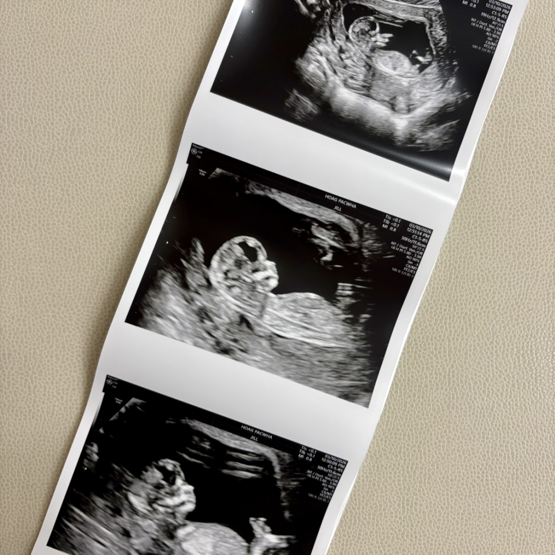 Photo shared by Devon for their Babylist baby registry.