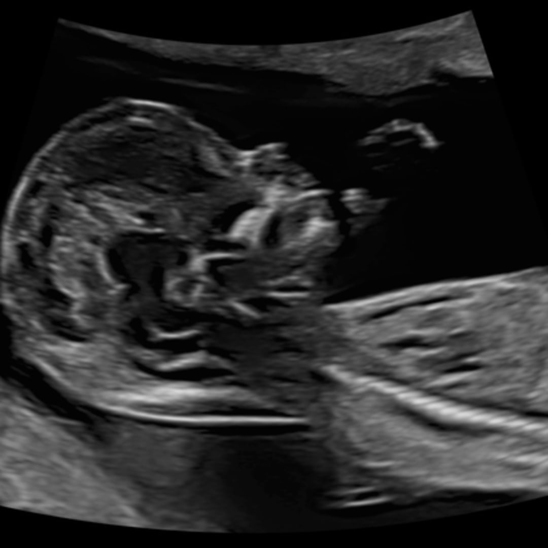 Photo shared by Emi for their Babylist baby registry.