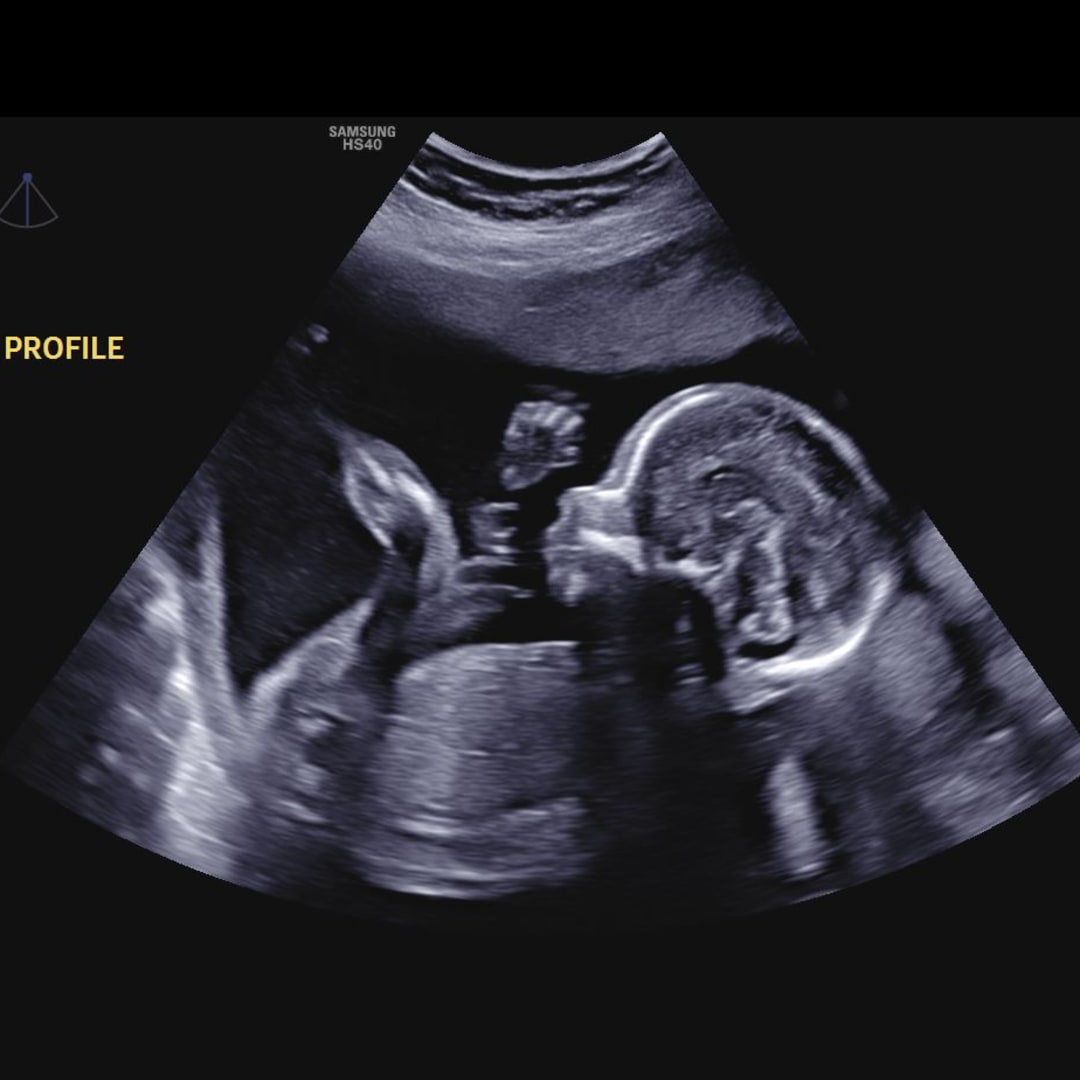 Photo shared by Alyssa for their Babylist baby registry.