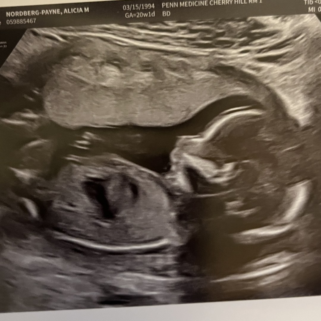 Photo shared by Alicia for their Babylist baby registry.