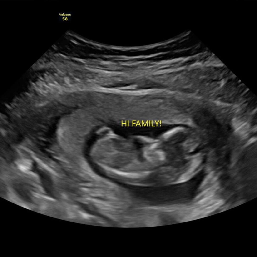 Photo shared by Jolie for their Babylist baby registry.