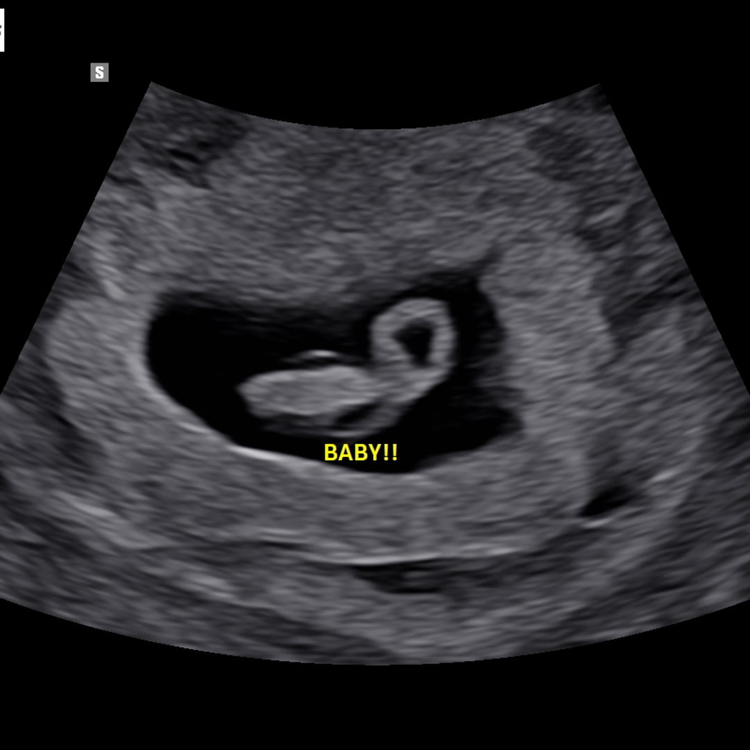 Photo shared by Wendy for their Babylist baby registry.