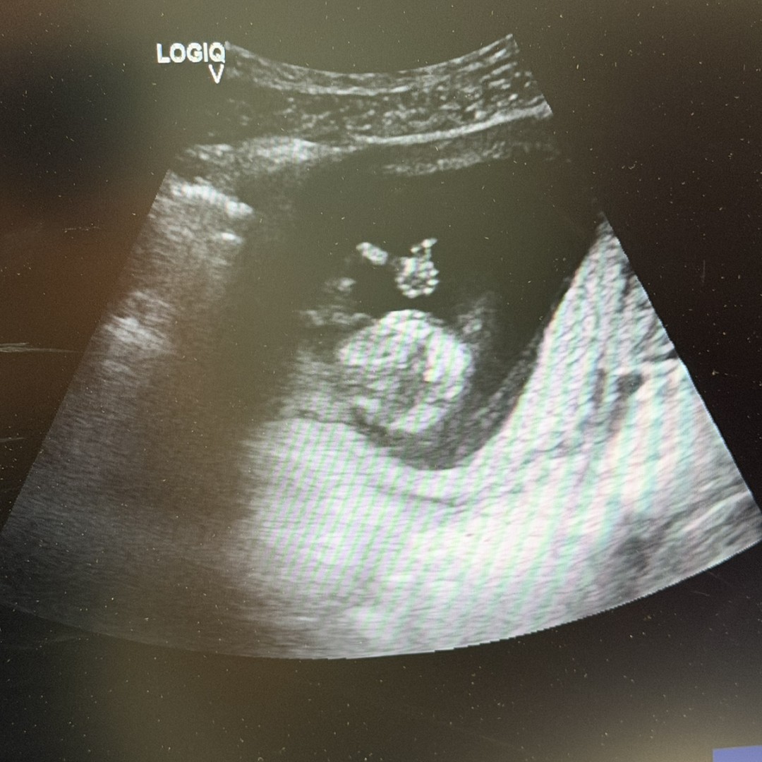 Photo shared by Jamie for their Babylist baby registry.