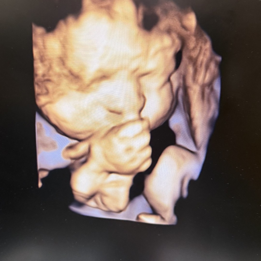Photo shared by Martha for their Babylist baby registry.