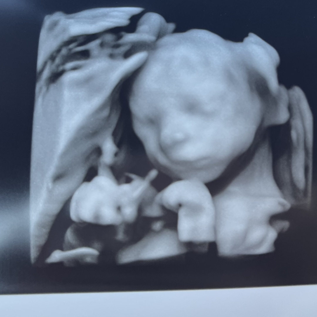Photo shared by Emily for their Babylist baby registry.