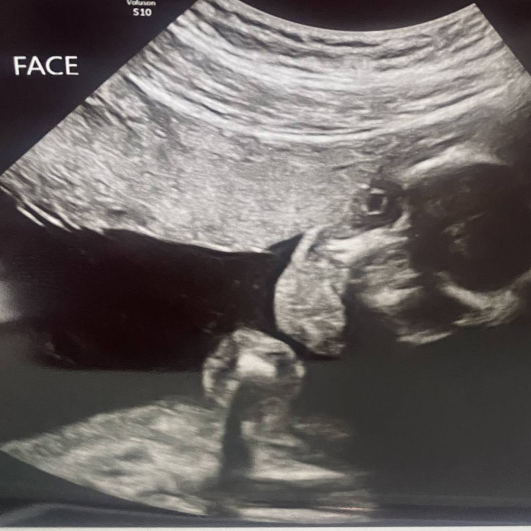 Photo shared by Katherine for their Babylist baby registry.