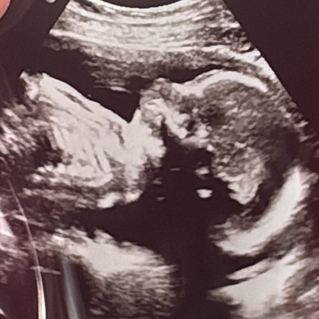 Photo shared by Isabella for their Babylist baby registry.