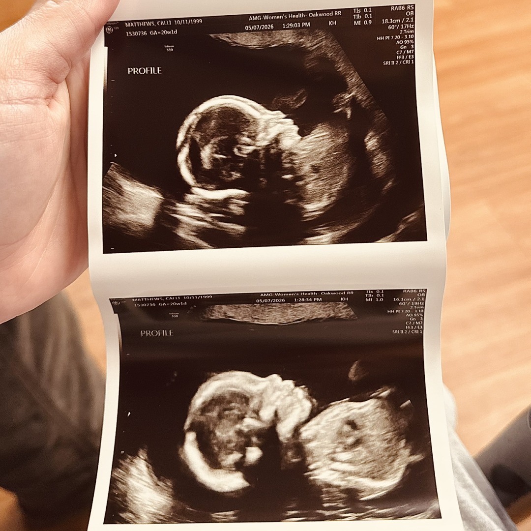 Photo shared by Calli for their Babylist baby registry.