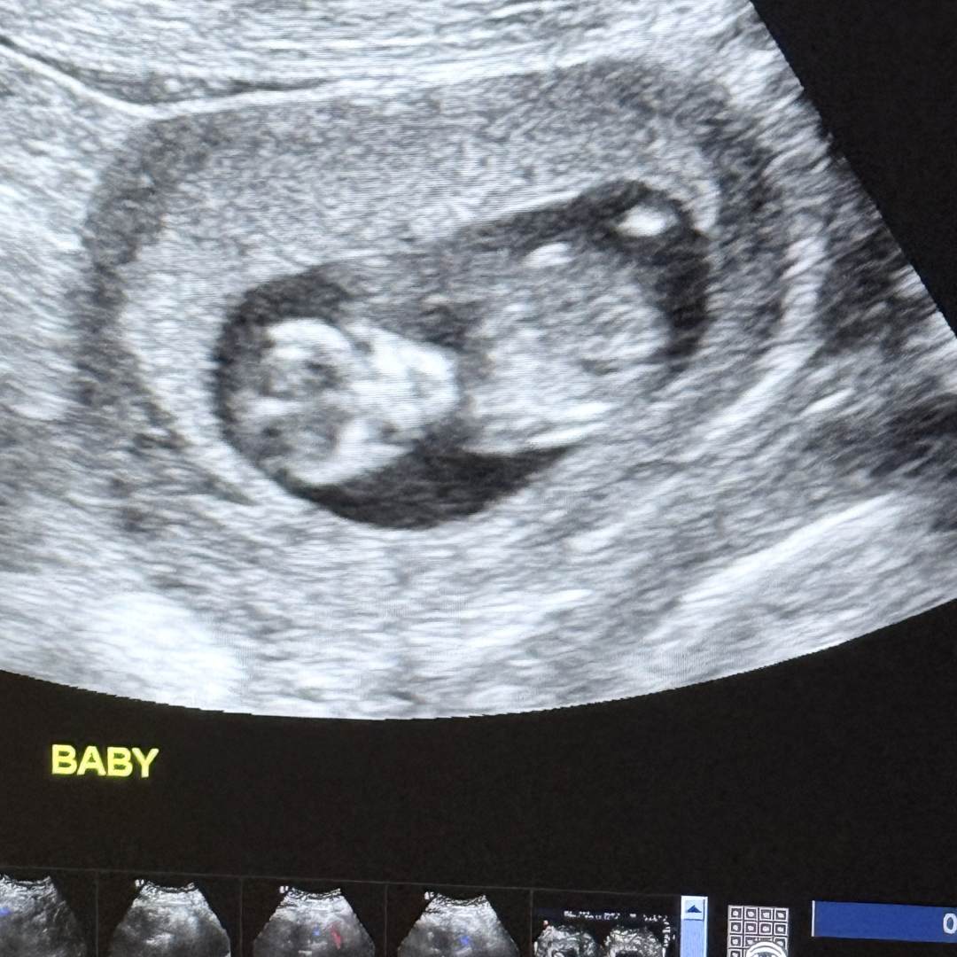 Photo shared by Karina for their Babylist baby registry.