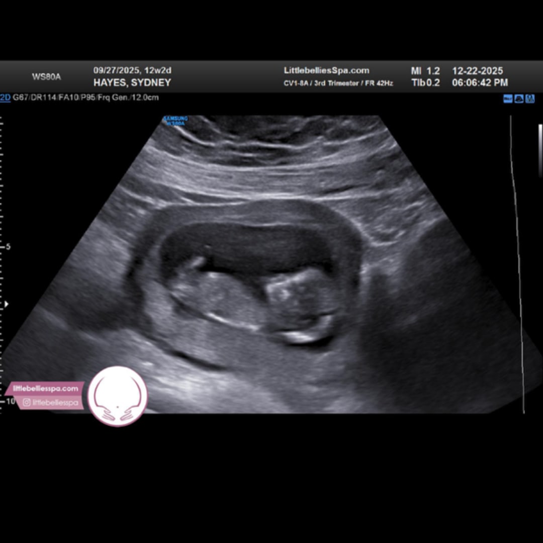 Photo shared by Sydney for their Babylist baby registry.