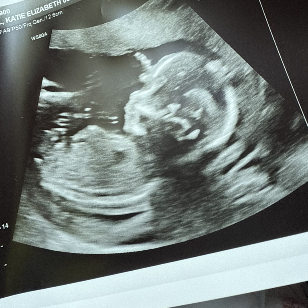 Photo shared by Katie for their Babylist baby registry.
