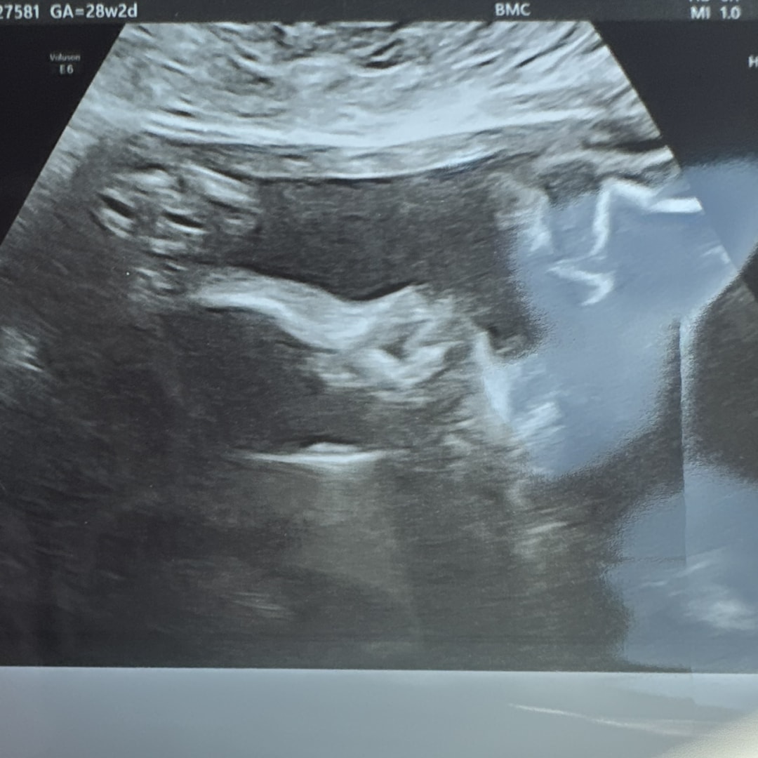Photo shared by Elba for their Babylist baby registry.