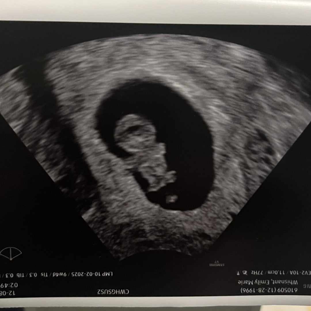 Photo shared by Emily for their Babylist baby registry.