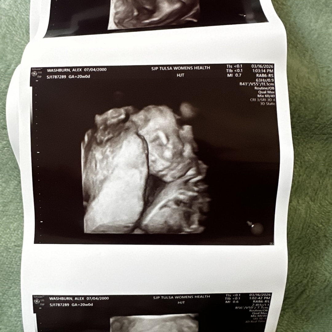 Photo shared by Alex for their Babylist baby registry.