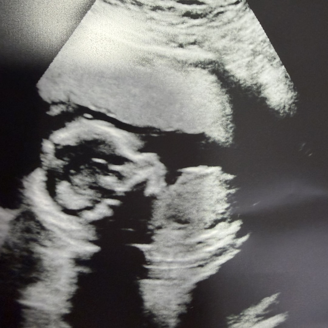 Photo shared by Courtney for their Babylist baby registry.