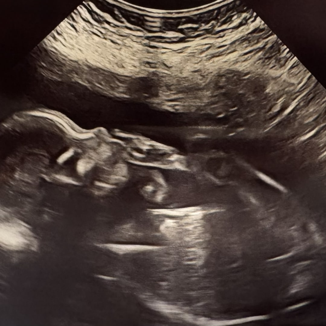 Photo shared by Kaitlyn for their Babylist baby registry.