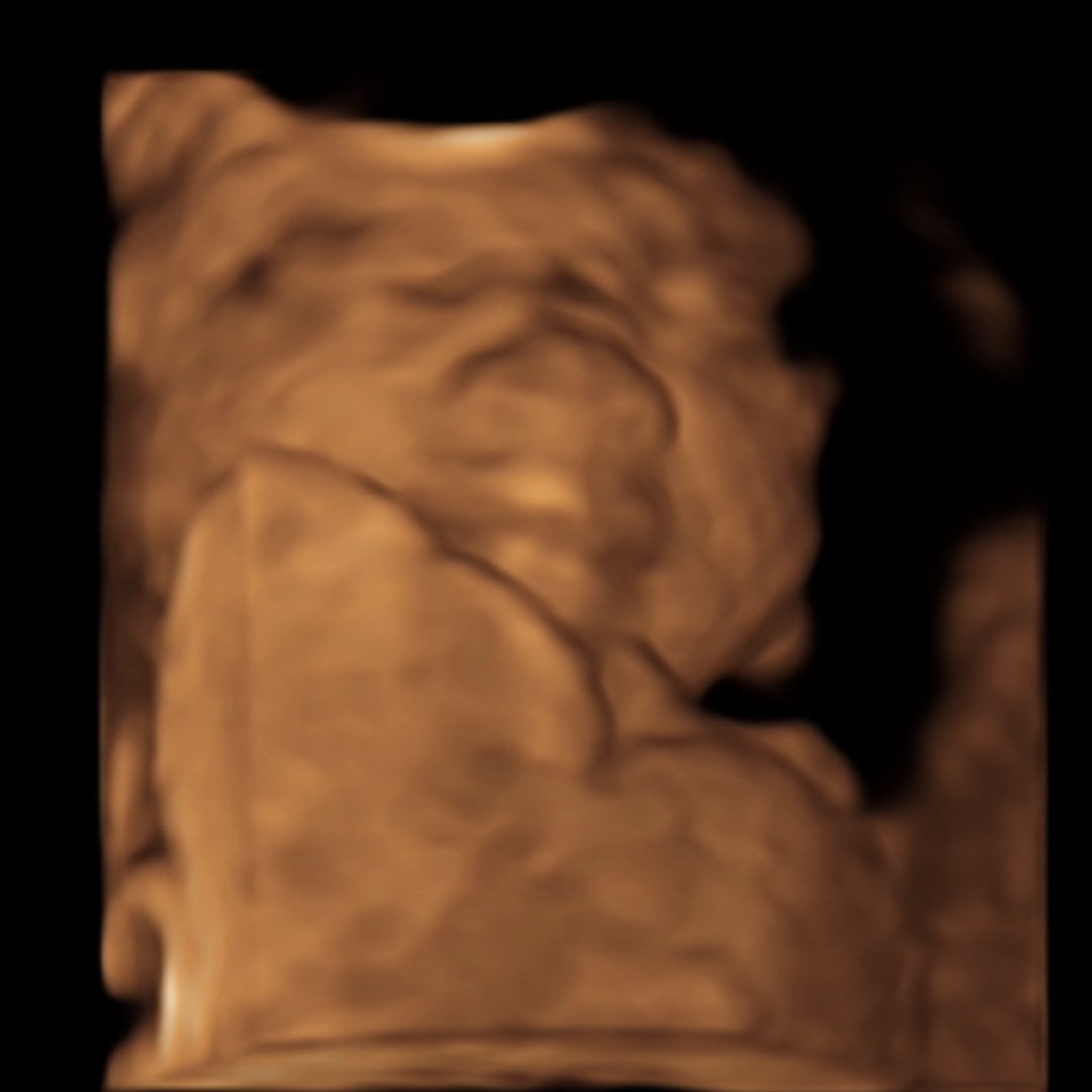 Photo shared by Lexi for their Babylist baby registry.