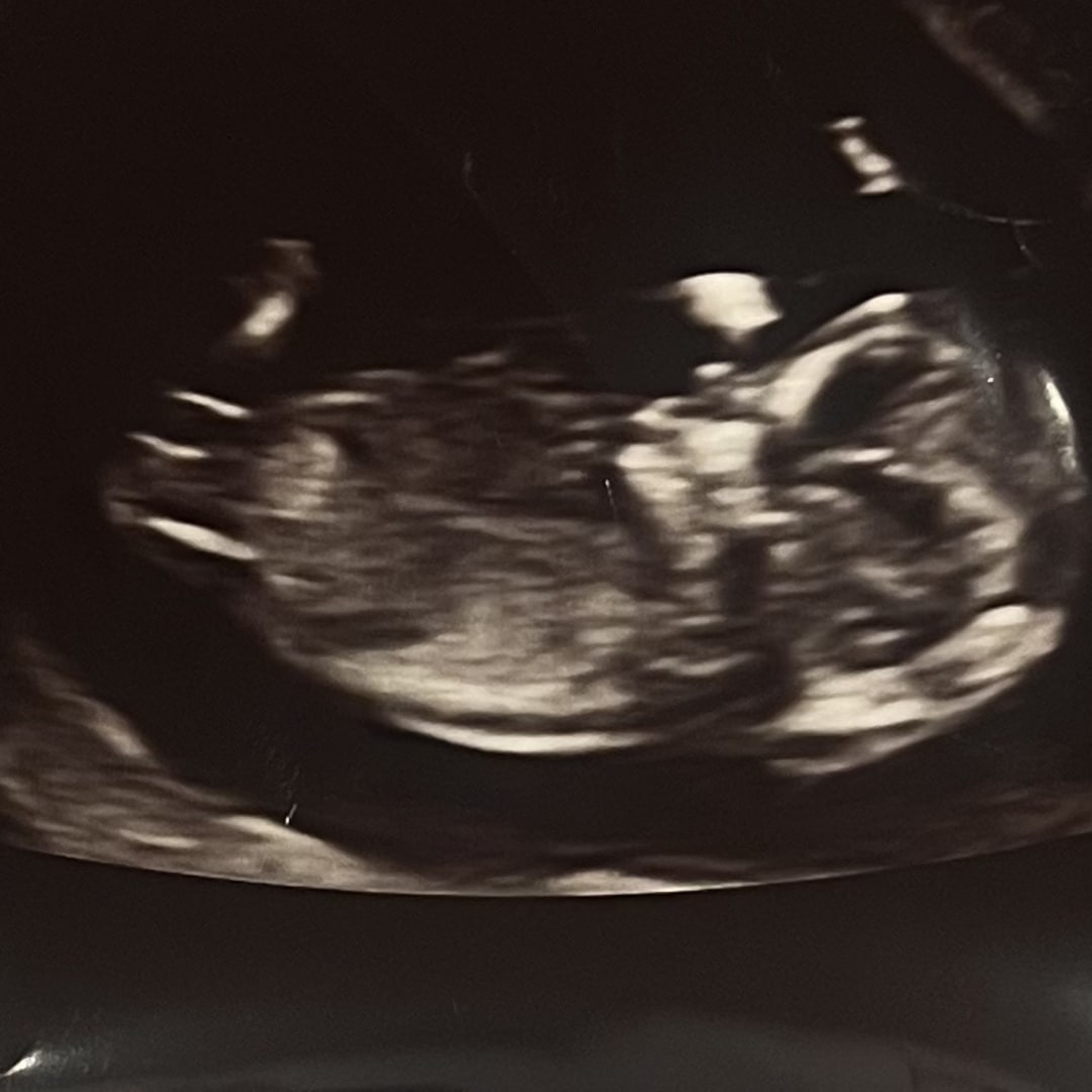 Photo shared by Kaitlyn for their Babylist baby registry.