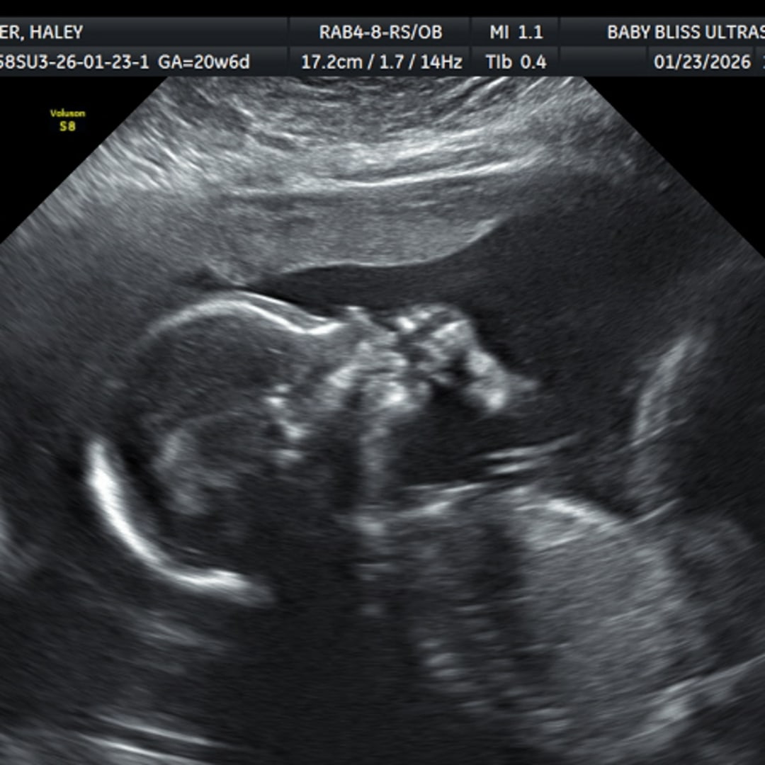 Photo shared by Haley for their Babylist baby registry.