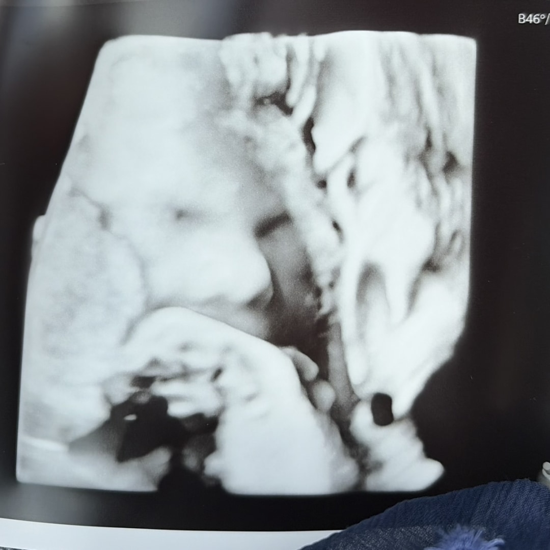 Photo shared by Christina for their Babylist baby registry.