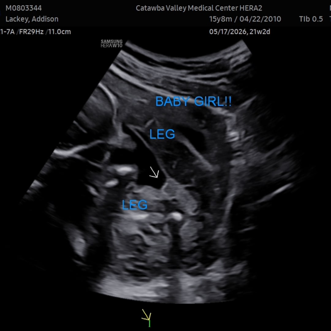 Photo shared by Addie for their Babylist baby registry.