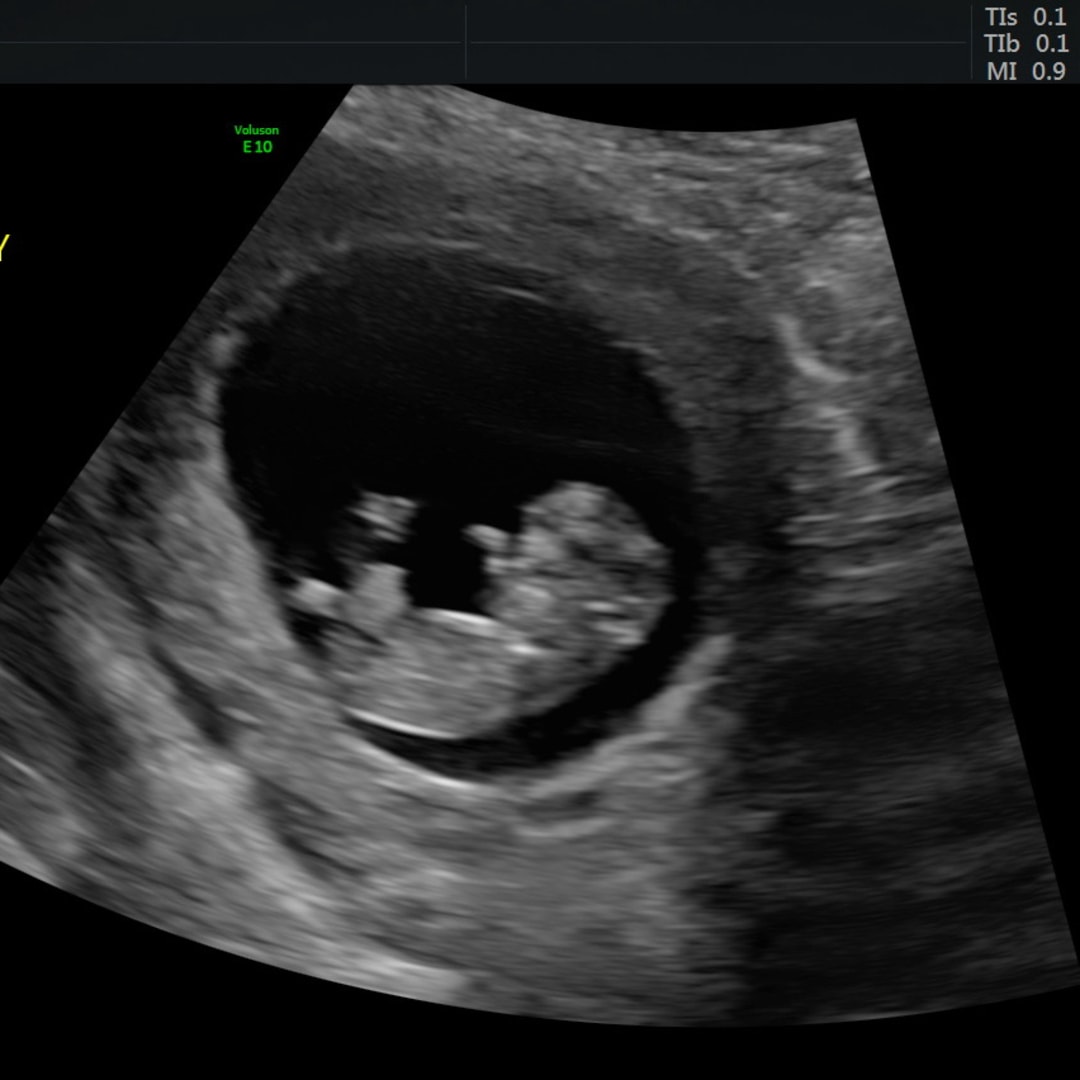 Photo shared by Aunistee for their Babylist baby registry.