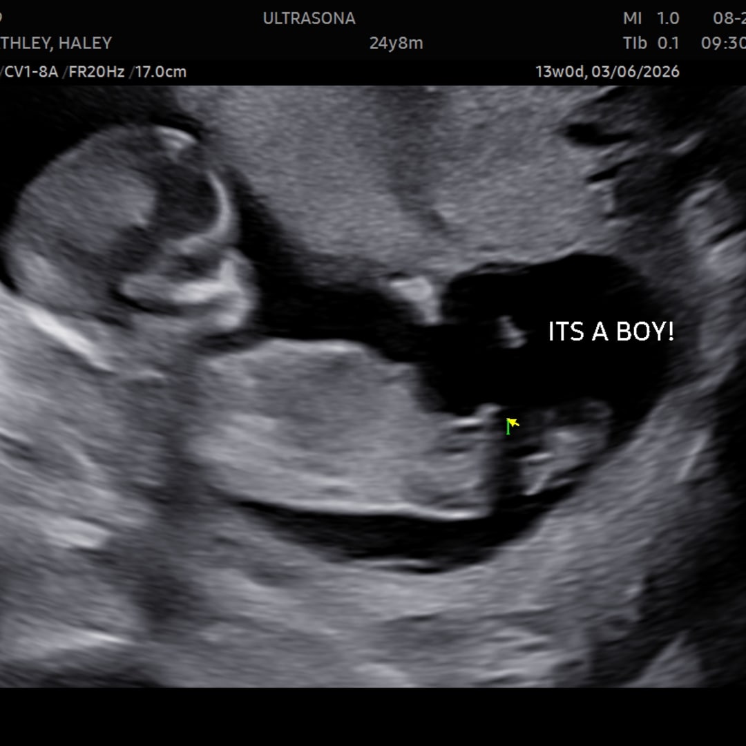 Photo shared by Haley for their Babylist baby registry.