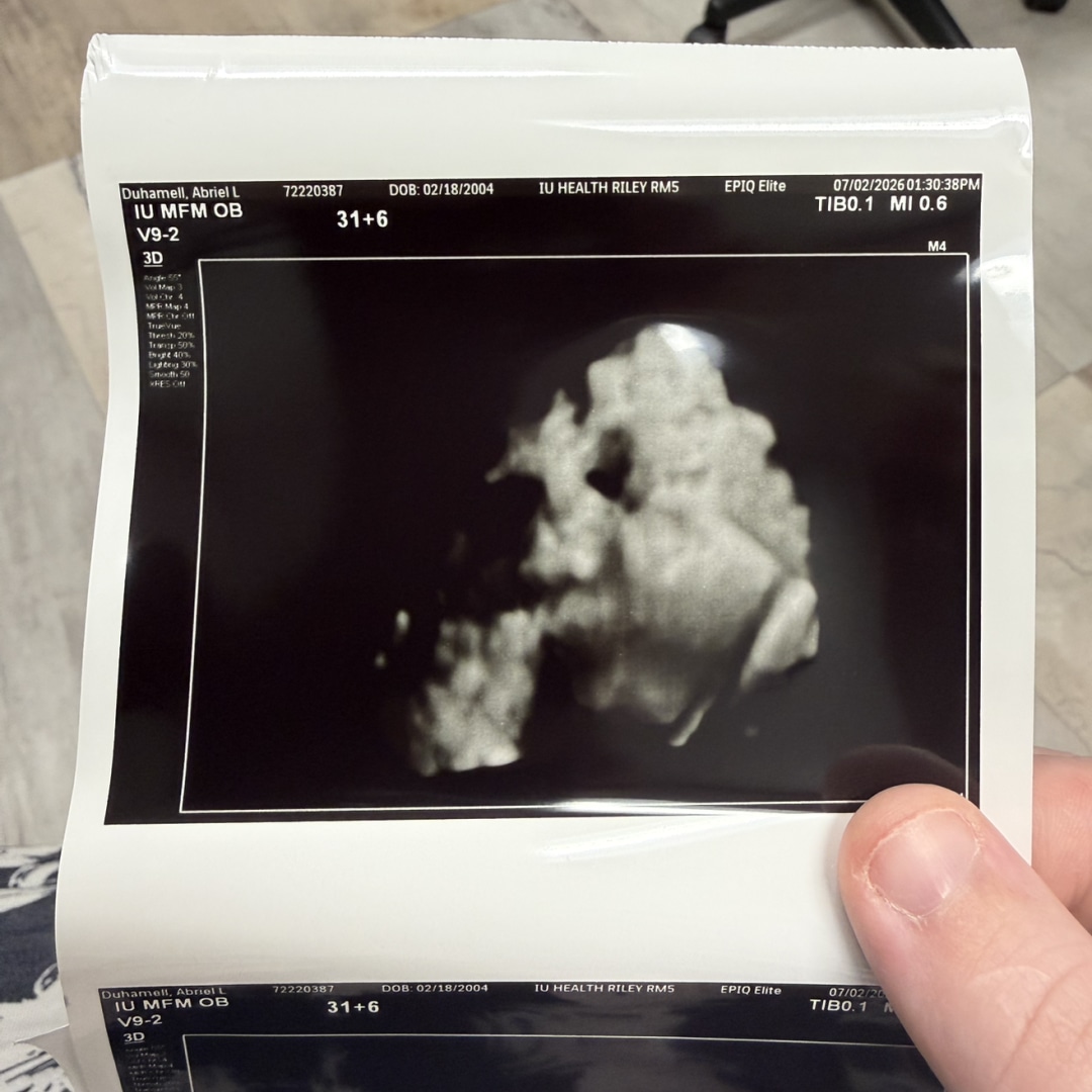 Photo shared by Abriel for their Babylist baby registry.