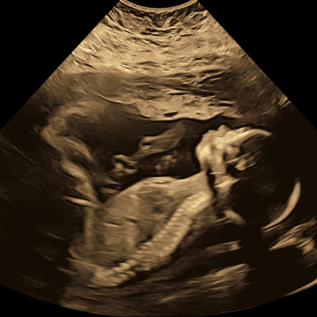 Photo shared by Calvina for their Babylist baby registry.