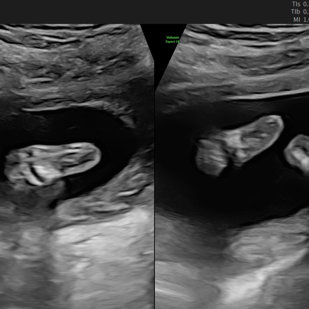 Photo shared by Rebecca for their Babylist baby registry.