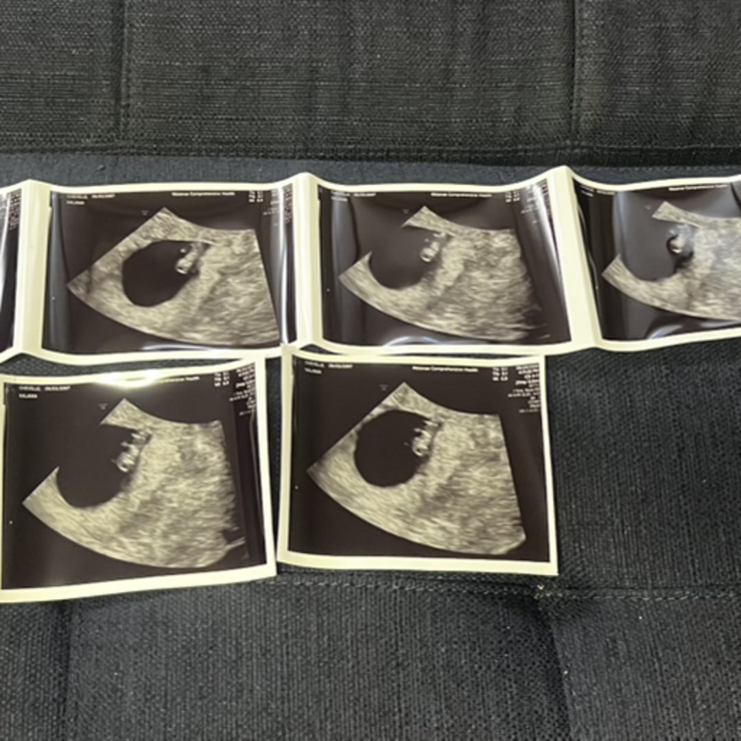Photo shared by Chevelle for their Babylist baby registry.